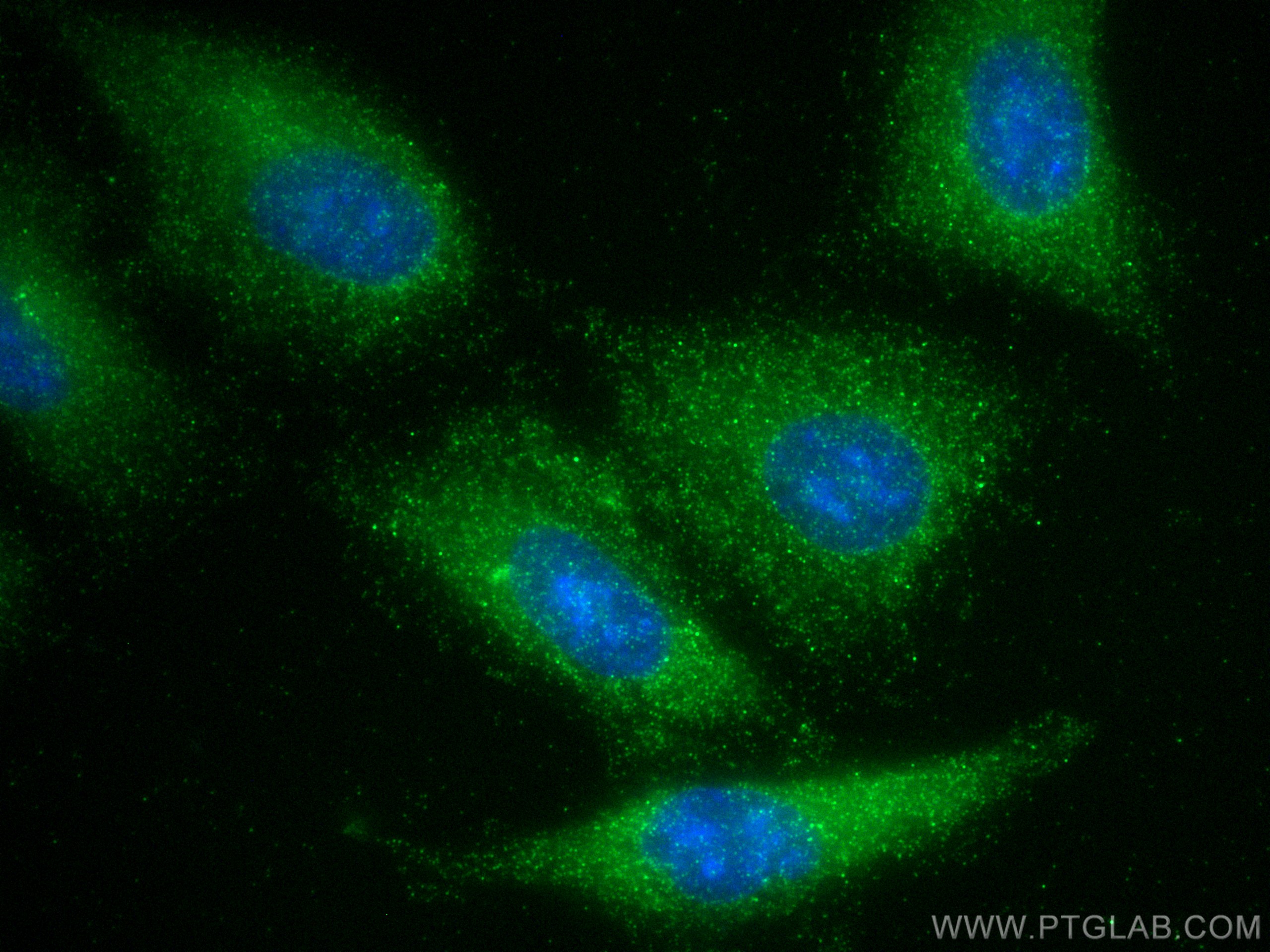 Immunofluorescence (IF) / fluorescent staining of A549 cells using CIB1 Polyclonal antibody (11823-1-AP)