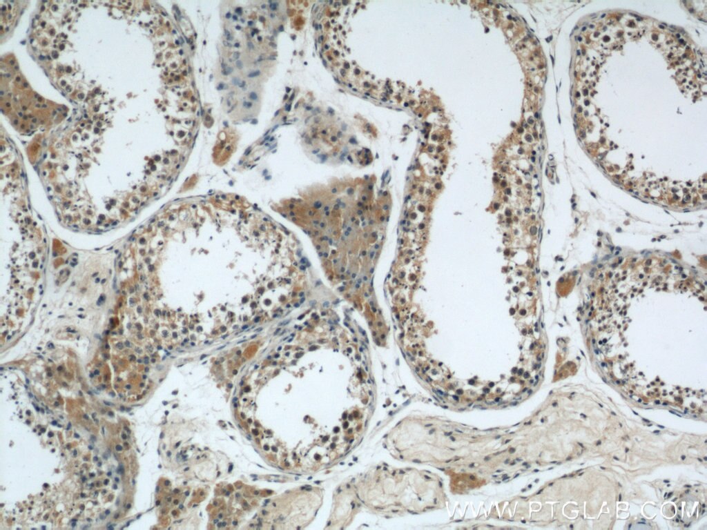 IHC staining of human testis using 11823-1-AP