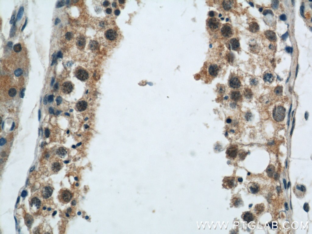 Immunohistochemistry (IHC) staining of human testis tissue using CIB1 Polyclonal antibody (11823-1-AP)