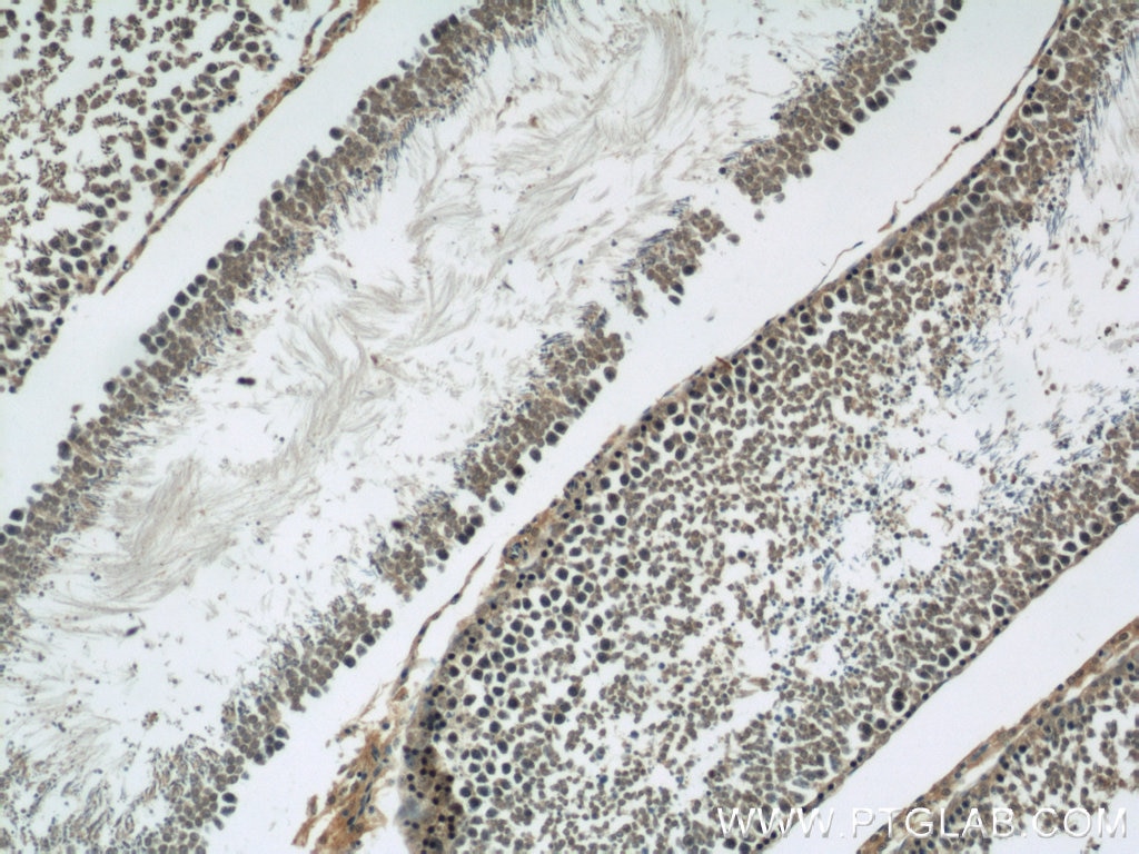 Immunohistochemistry (IHC) staining of rat testis tissue using CIB1 Polyclonal antibody (11823-1-AP)