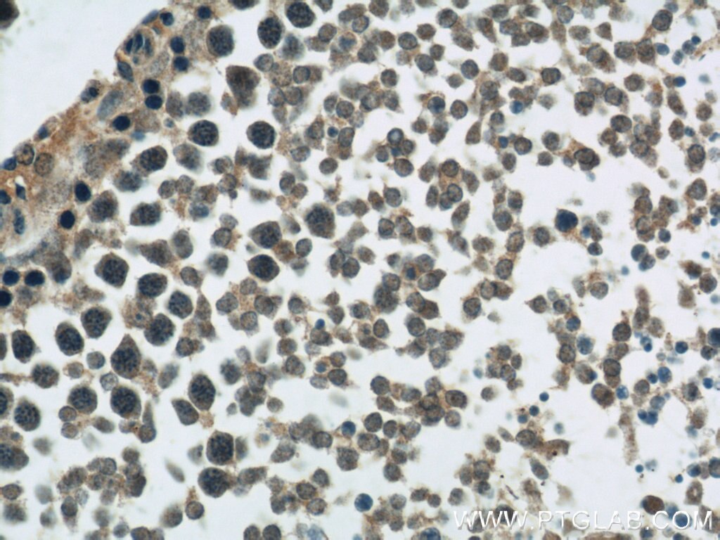 Immunohistochemistry (IHC) staining of rat testis tissue using CIB1 Polyclonal antibody (11823-1-AP)