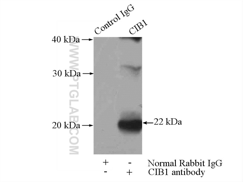 IP experiment of mouse testis using 11823-1-AP