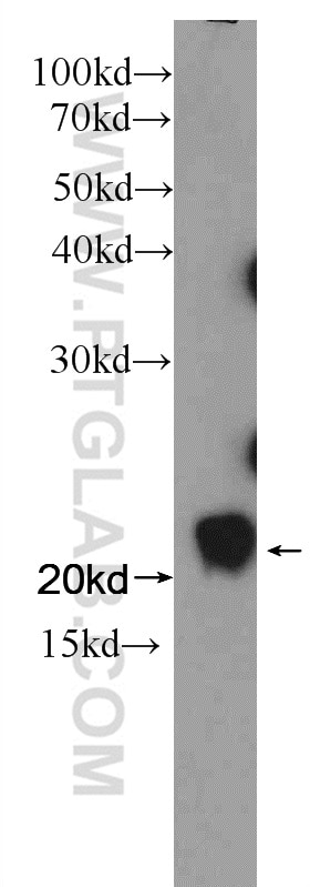 Western Blot (WB) analysis of rat testis tissue using CIB1 Polyclonal antibody (11823-1-AP)