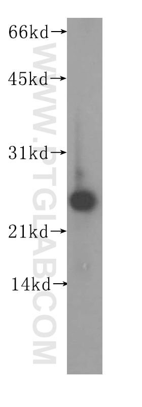 Western Blot (WB) analysis of human liver tissue using CIB1 Polyclonal antibody (11823-1-AP)