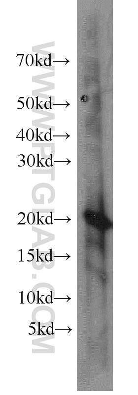 Western Blot (WB) analysis of HepG2 cells using CIB1 Polyclonal antibody (11823-1-AP)