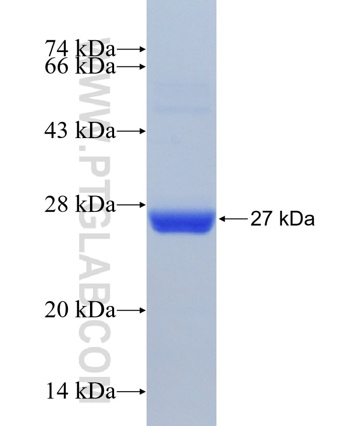 CIB1 fusion protein Ag31174 SDS-PAGE