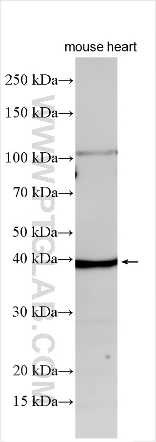 Western Blot (WB) analysis of various lysates using CIB2 Polyclonal antibody (32585-1-AP)