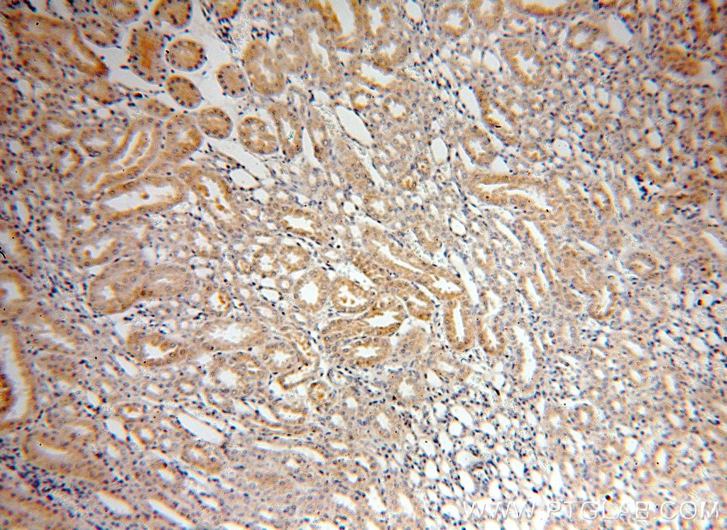 Immunohistochemistry (IHC) staining of human kidney tissue using CIB4 Polyclonal antibody (18840-1-AP)