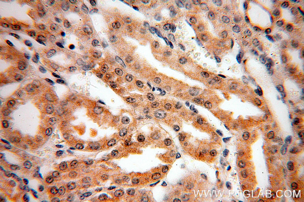 Immunohistochemistry (IHC) staining of human kidney tissue using CIB4 Polyclonal antibody (18840-1-AP)