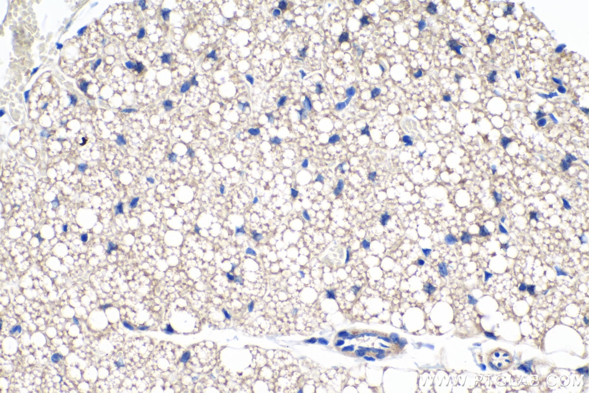 Immunohistochemistry (IHC) staining of mouse brown adipose tissue using CIDEA Polyclonal antibody (13170-1-AP)