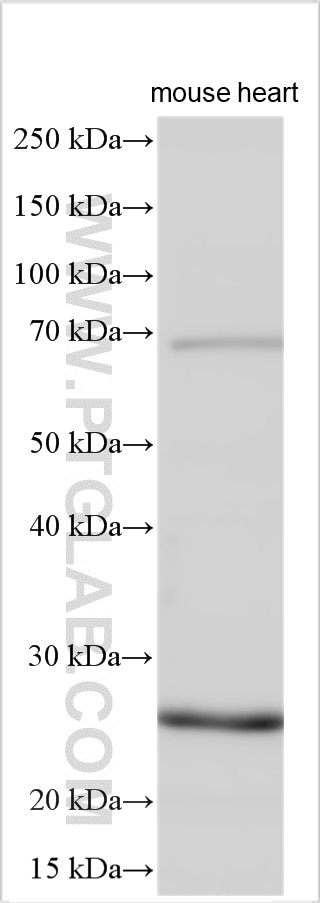Western Blot (WB) analysis of various lysates using CIDEA Polyclonal antibody (13170-1-AP)