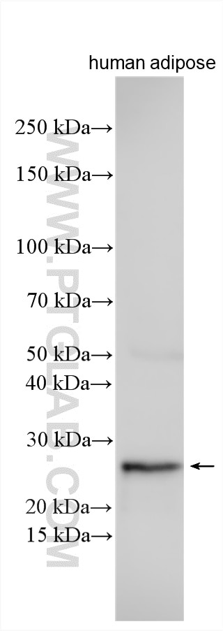 Western Blot (WB) analysis of various lysates using CIDEA Polyclonal antibody (13170-1-AP)