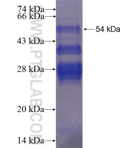 CIDEA fusion protein Ag3824 SDS-PAGE