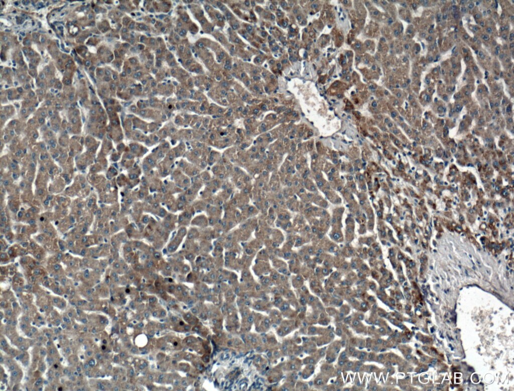 Immunohistochemistry (IHC) staining of human liver tissue using CIDEB Polyclonal antibody (27600-1-AP)