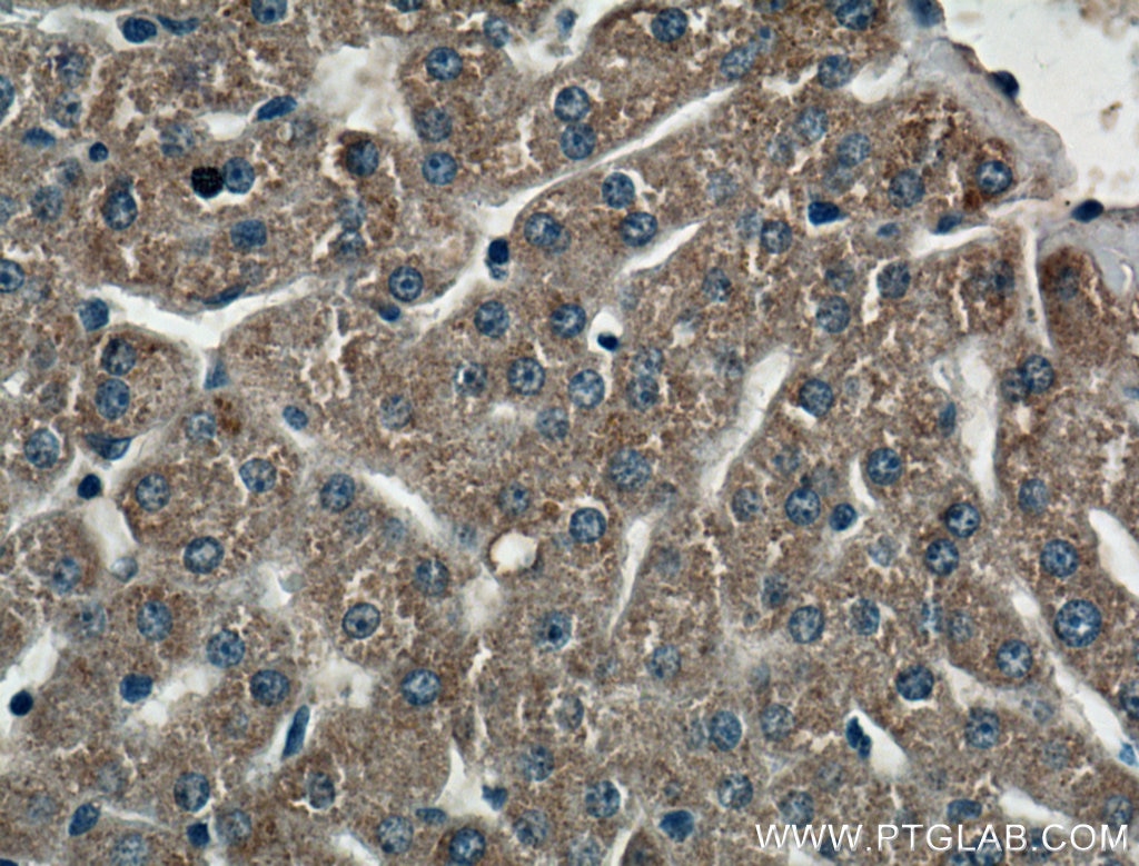 Immunohistochemistry (IHC) staining of human liver tissue using CIDEB Polyclonal antibody (27600-1-AP)