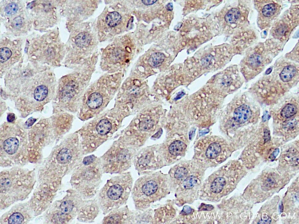 Immunohistochemistry (IHC) staining of mouse liver tissue using CIDEB Polyclonal antibody (27600-1-AP)