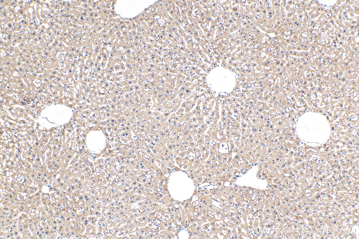 Immunohistochemistry (IHC) staining of mouse liver tissue using CIDEB Polyclonal antibody (27600-1-AP)