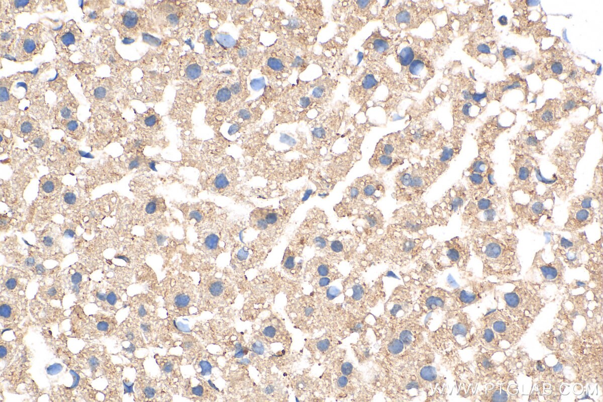 Immunohistochemistry (IHC) staining of mouse liver tissue using CIDEB Polyclonal antibody (27600-1-AP)