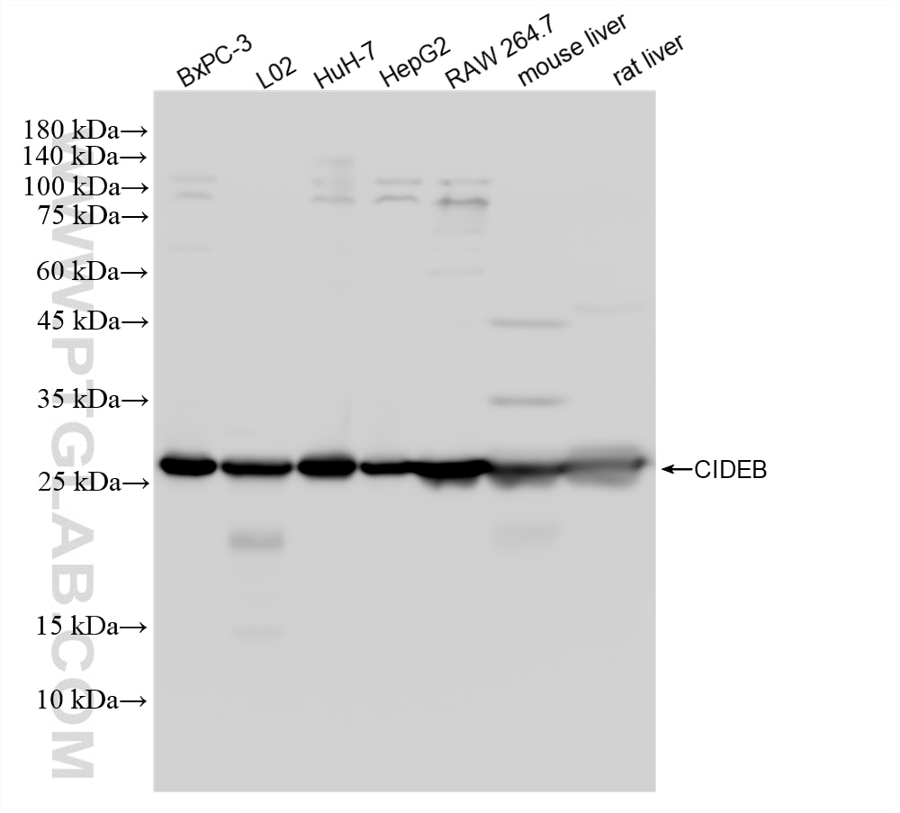 WB analysis using 88087-1-RR (same clone as 88087-1-PBS) Western Blot (WB) analysis of various lysates using CIDEB Recombinant monoclonal antibody (88087-1-RR)