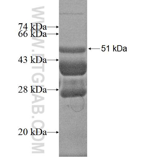 CIDEB fusion protein Ag2492 SDS-PAGE