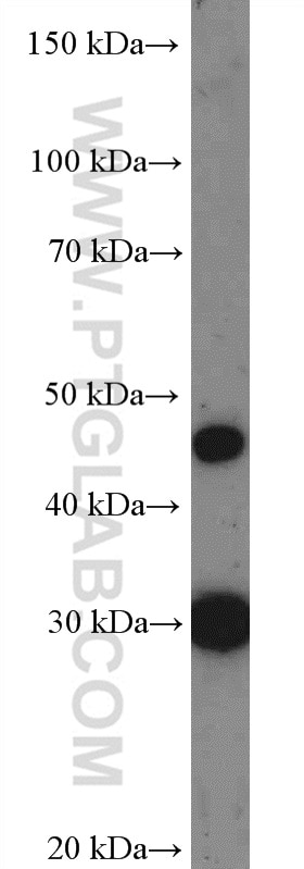 Western Blot (WB) analysis of HeLa cells using CIDEC Polyclonal antibody (12287-1-AP)