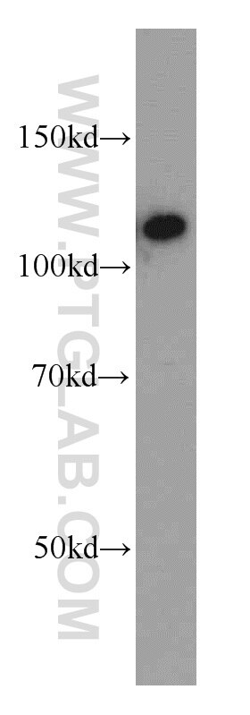 Western Blot (WB) analysis of K-562 cells using CIITA Polyclonal antibody (55099-1-AP)