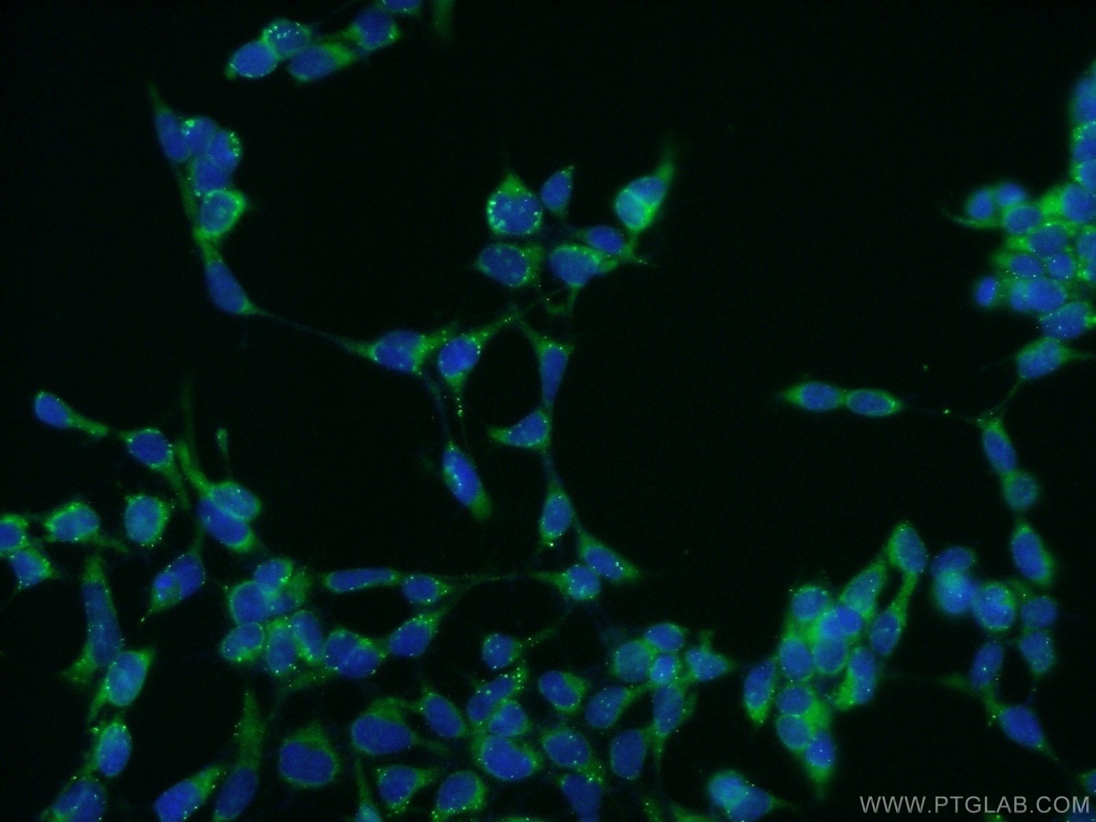 Immunofluorescence (IF) / fluorescent staining of HEK-293 cells using CILP2 Polyclonal antibody (11813-1-AP)