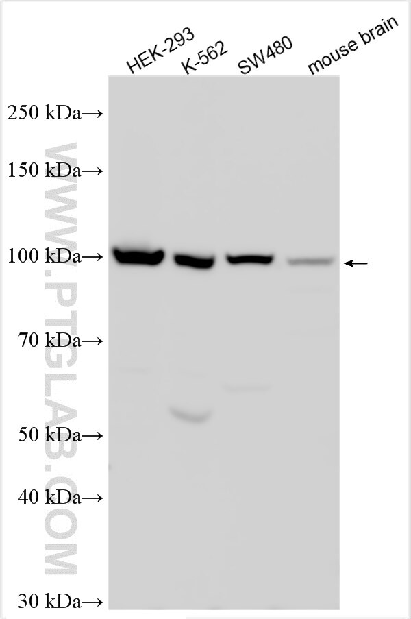 Western Blot (WB) analysis of various lysates using CILP2 Polyclonal antibody (11813-1-AP)