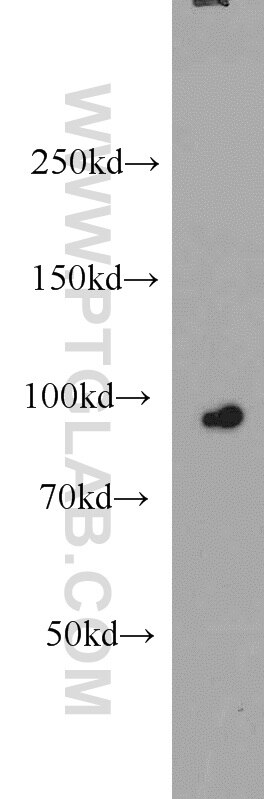 Western Blot (WB) analysis of HEK-293 cells using CILP2 Polyclonal antibody (11813-1-AP)