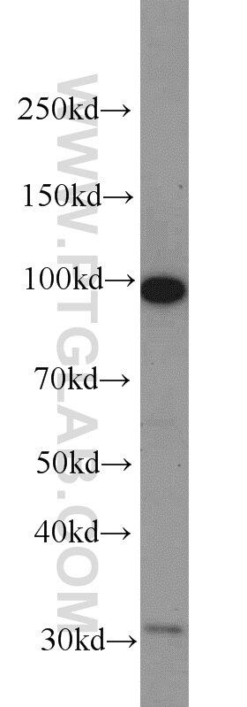 Western Blot (WB) analysis of K-562 cells using CILP2 Polyclonal antibody (11813-1-AP)
