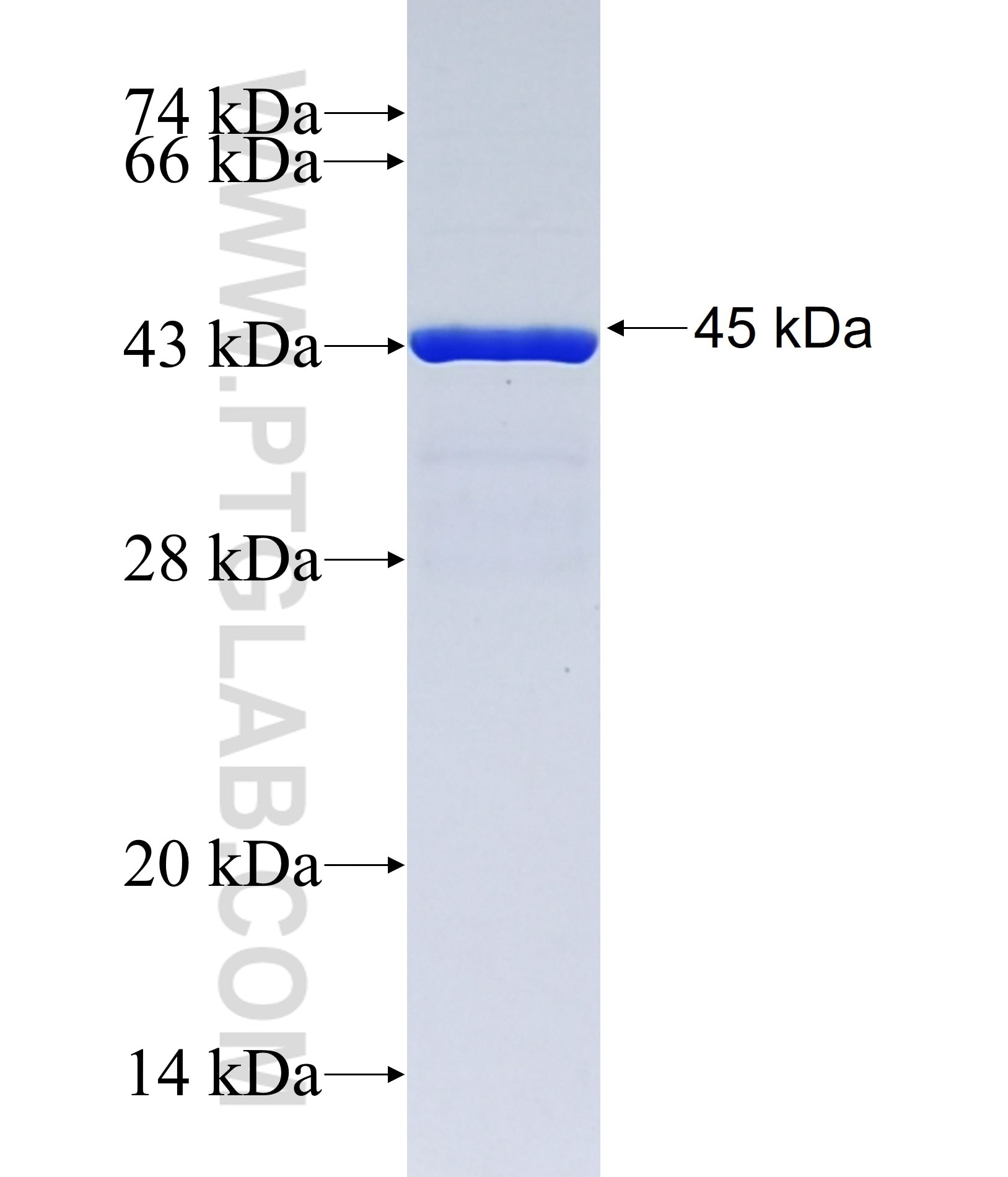 CILP2 fusion protein Ag38067 SDS-PAGE