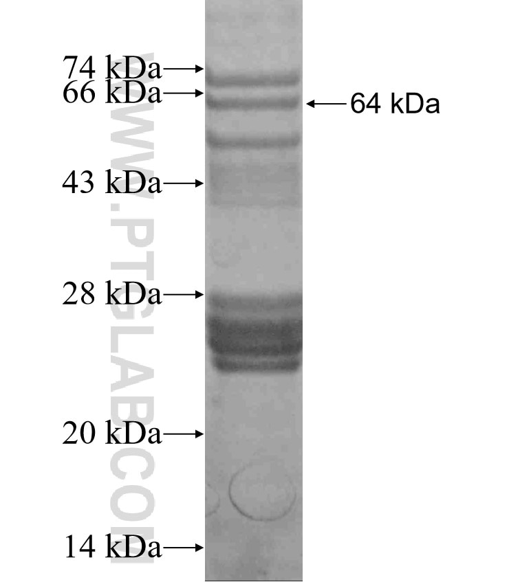 CILP2 fusion protein Ag2366 SDS-PAGE