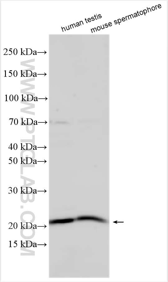 WB analysis using 33446-1-AP (same clone as 33446-1-PBS) Western Blot (WB) analysis of various lysates using CIMIP2C Polyclonal antibody (33446-1-AP)