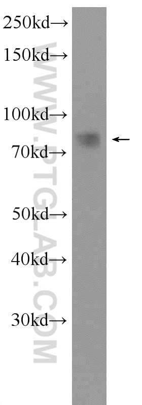 Western Blot (WB) analysis of fetal human brain tissue using CIN85 Polyclonal antibody (12132-1-AP)