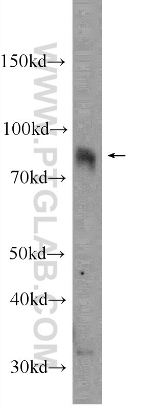 CIN85 Polyclonal antibody