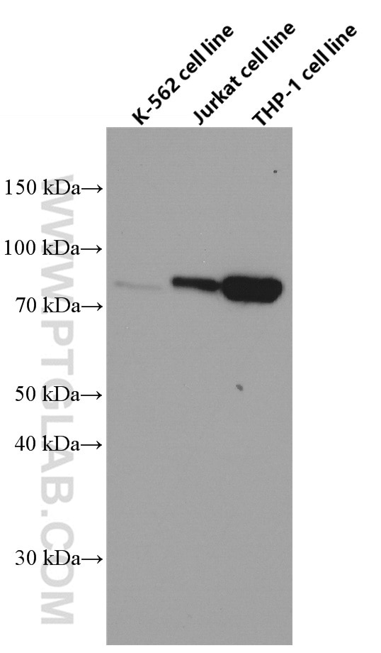 CIN85