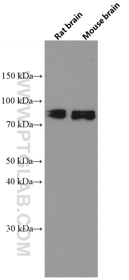 Western Blot (WB) analysis of rat brain tissue using CIN85 Monoclonal antibody (66571-1-Ig)