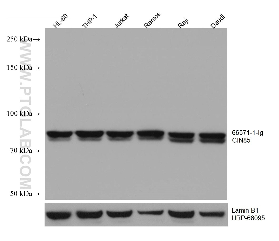 Western Blot (WB) analysis of various lysates using CIN85 Monoclonal antibody (66571-1-Ig)