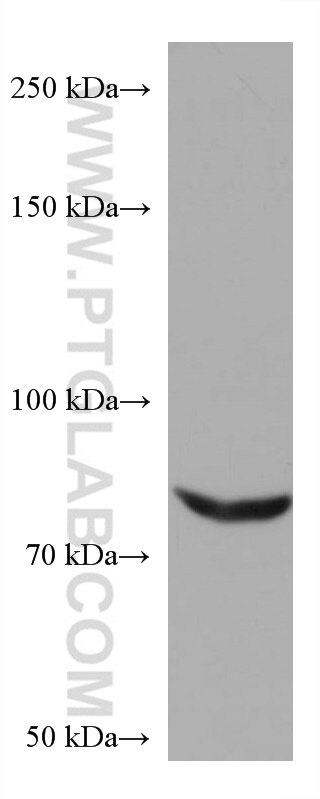 Western Blot (WB) analysis of K-562 cells using CIN85 Monoclonal antibody (66571-1-Ig)