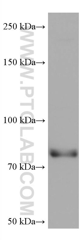 Western Blot (WB) analysis of PC-12 cells using CIN85 Monoclonal antibody (66571-1-Ig)