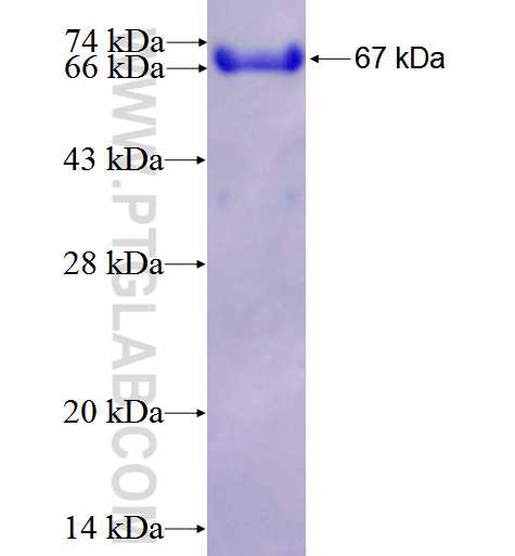 CIN85 fusion protein Ag2777 SDS-PAGE