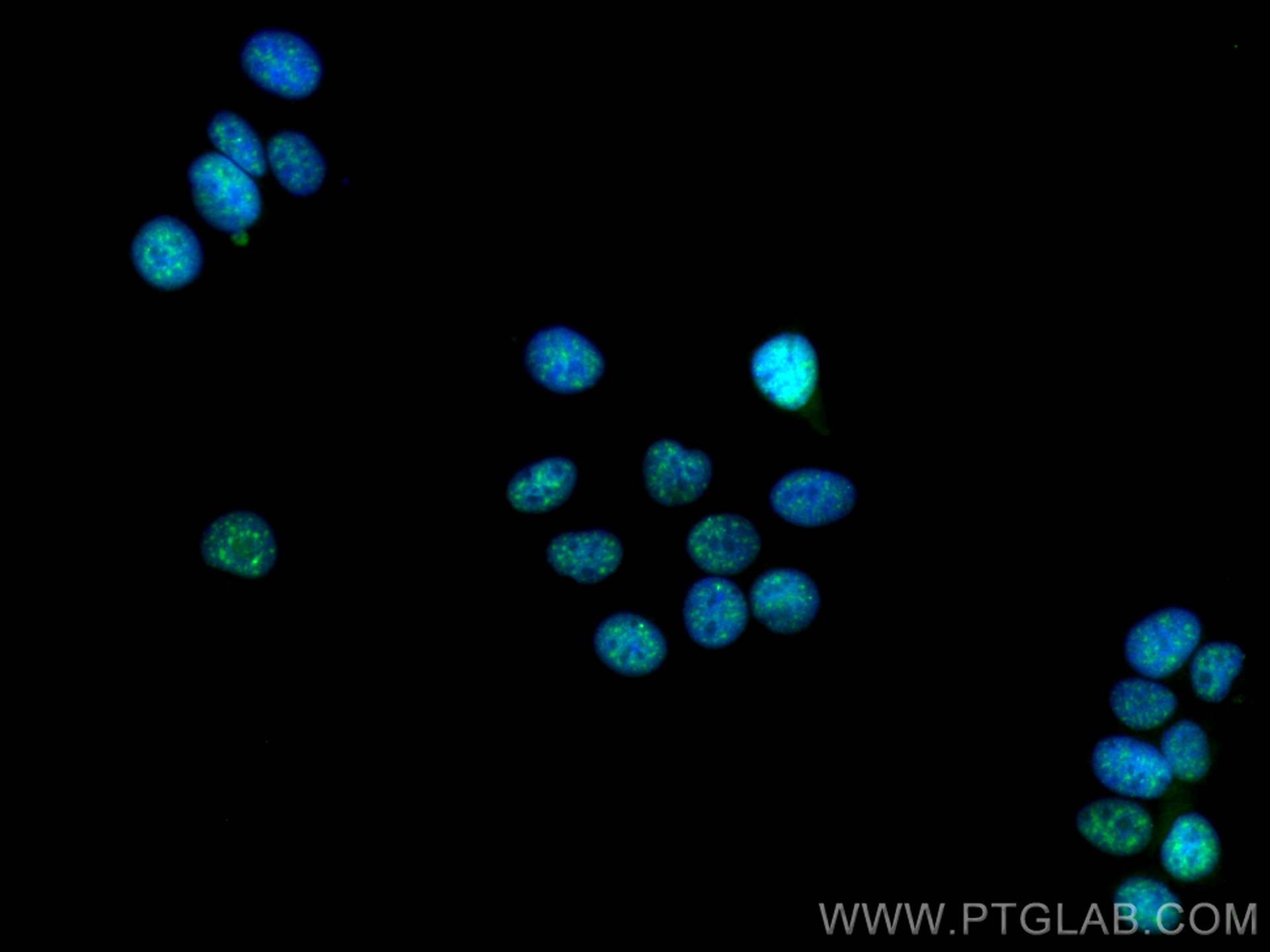 Immunofluorescence (IF) / fluorescent staining of MCF-7 cells using CIP29 Polyclonal antibody (15798-1-AP)