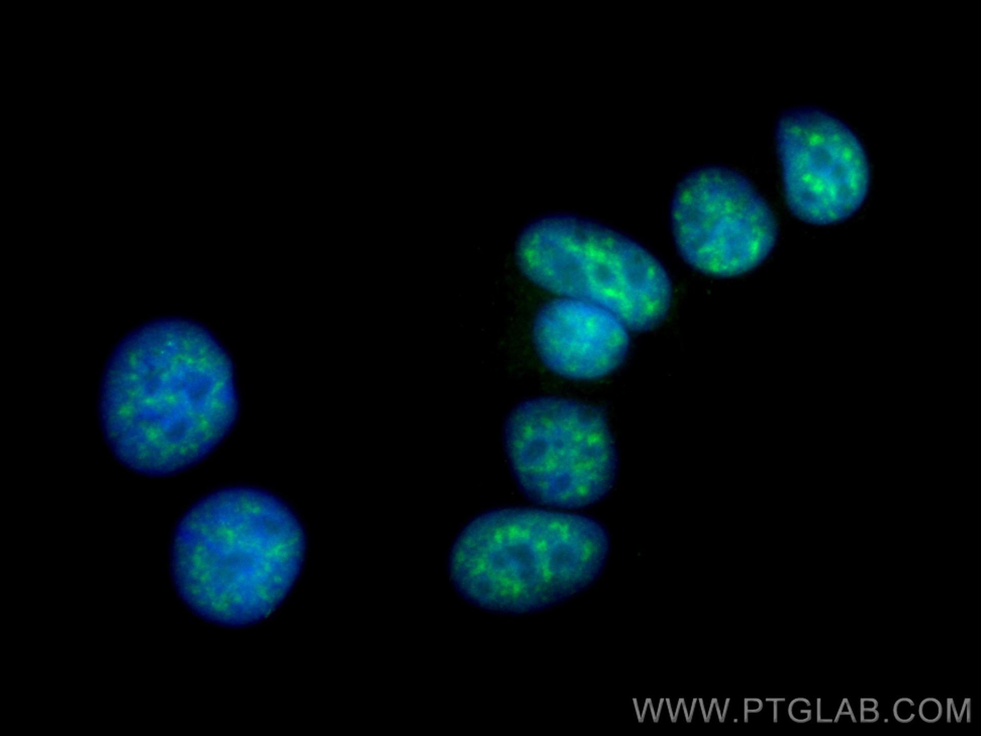 Immunofluorescence (IF) / fluorescent staining of MCF-7 cells using CIP29 Polyclonal antibody (15798-1-AP)