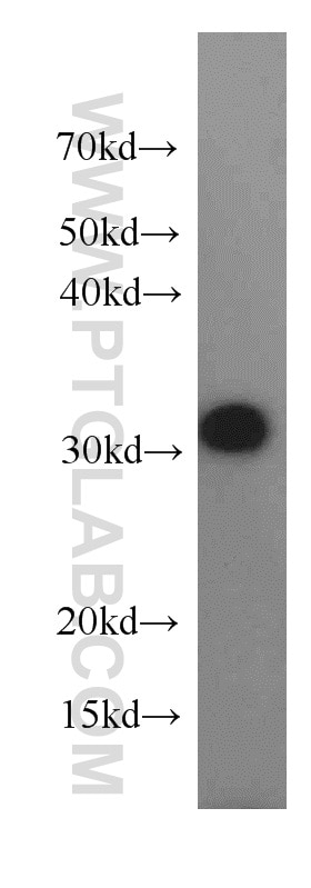 Western Blot (WB) analysis of Raji cells using CIP29 Polyclonal antibody (15798-1-AP)