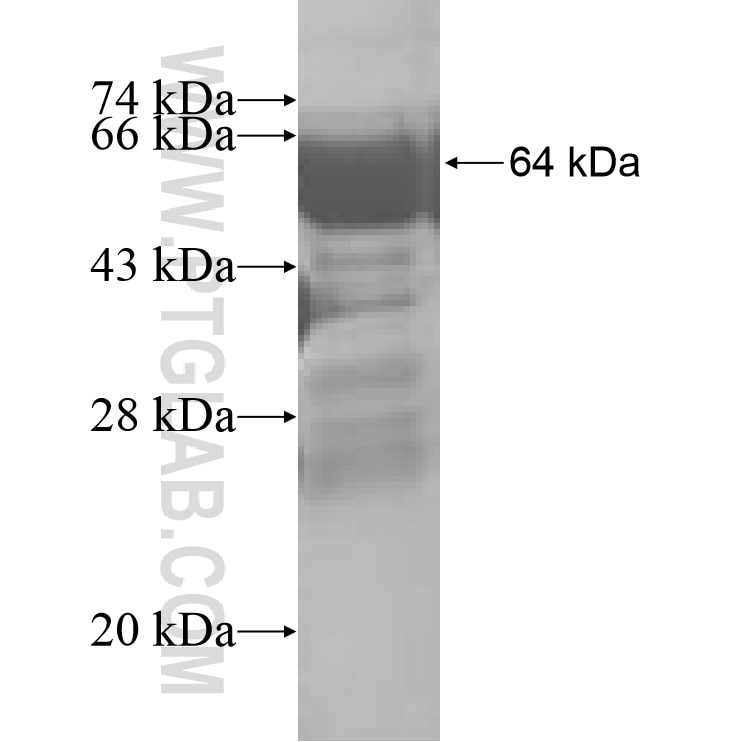 CIP29 fusion protein Ag8507 SDS-PAGE