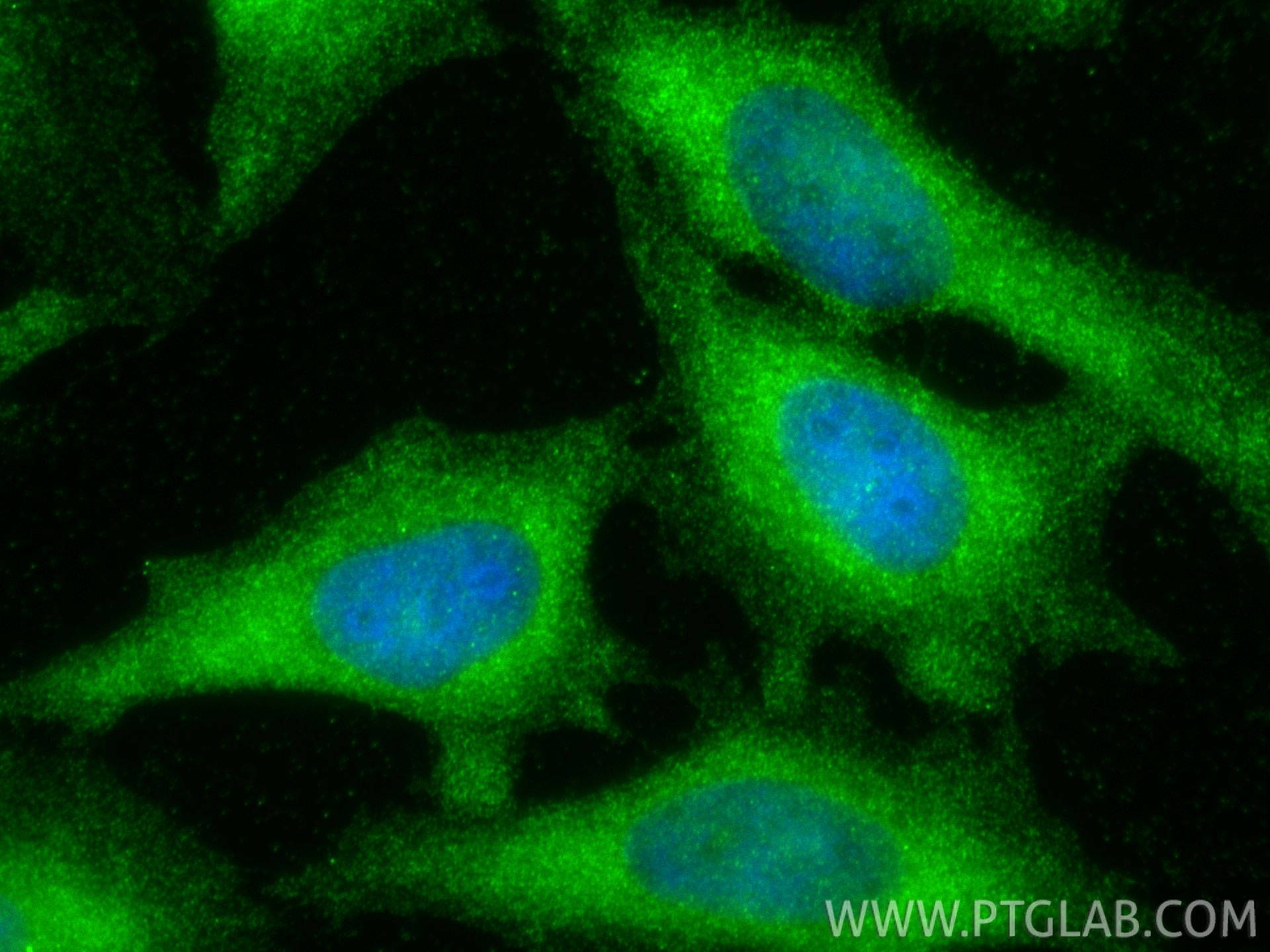 Immunofluorescence (IF) / fluorescent staining of HeLa cells using CIP2A Polyclonal antibody (23199-1-AP)