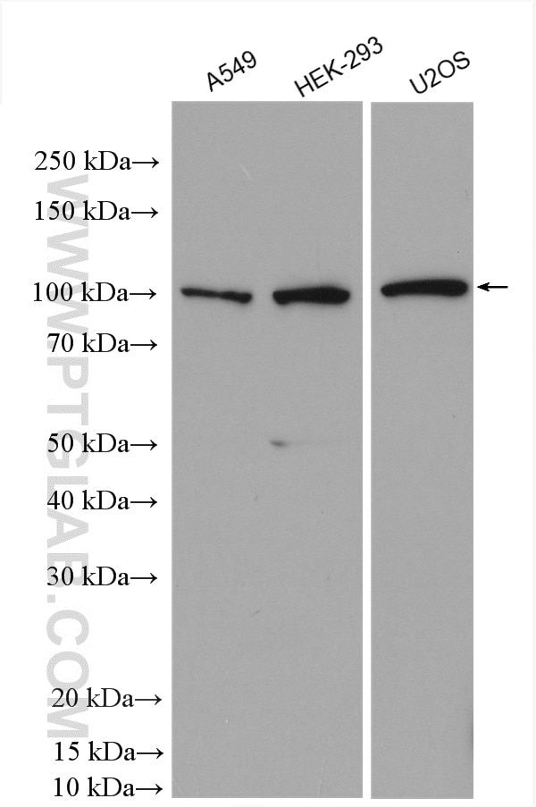 Western Blot (WB) analysis of various lysates using CIP2A Polyclonal antibody (23199-1-AP)
