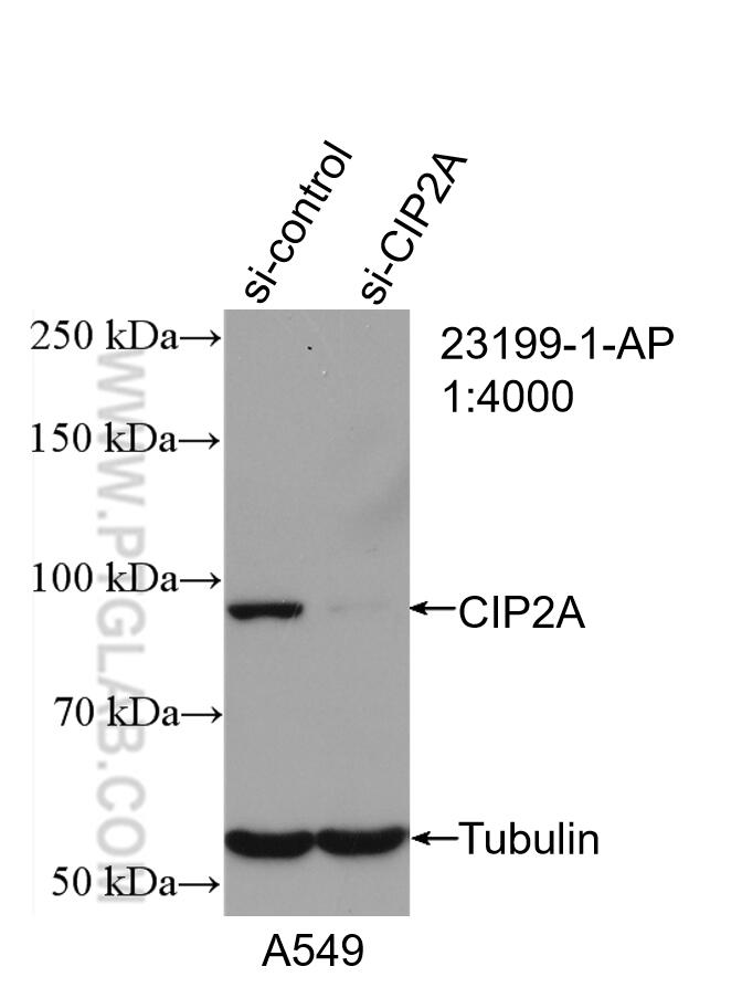Western Blot (WB) analysis of A549 cells using CIP2A Polyclonal antibody (23199-1-AP)