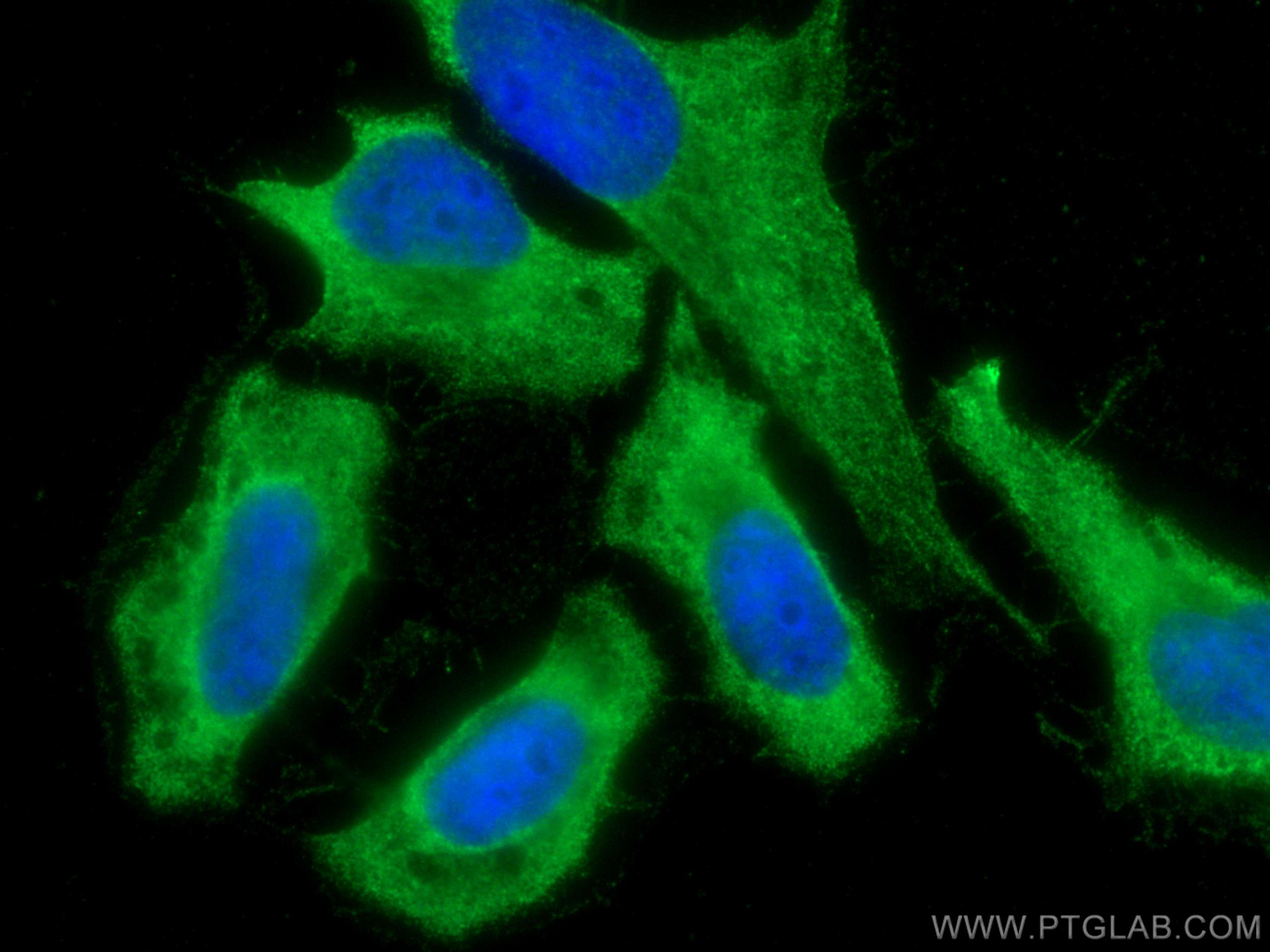 Immunofluorescence (IF) / fluorescent staining of HeLa cells using CoraLite® Plus 488-conjugated CIP2A Monoclonal ant (CL488-67843)