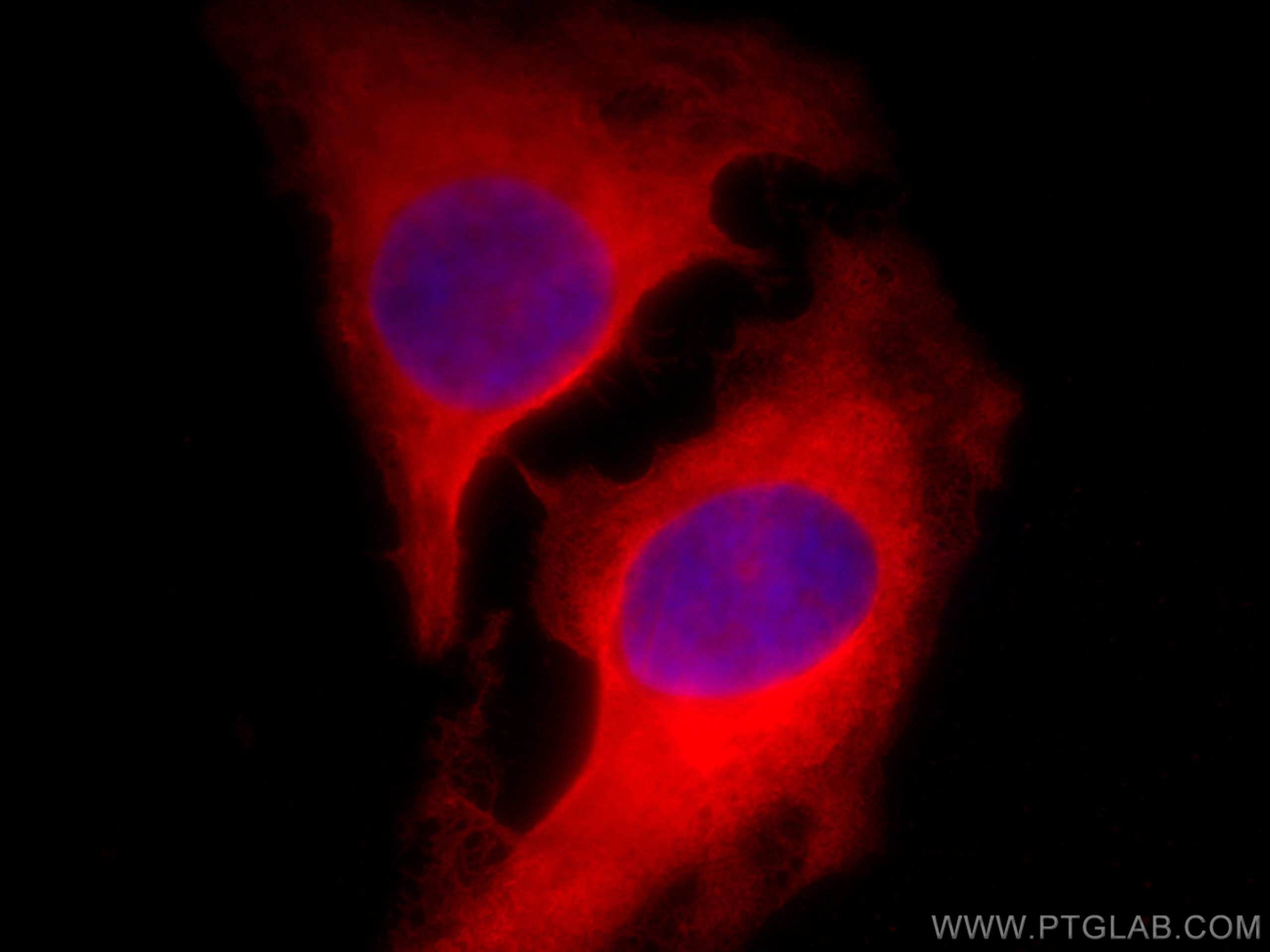Immunofluorescence (IF) / fluorescent staining of HeLa cells using CoraLite®594-conjugated CIP2A Monoclonal antibody (CL594-67843)